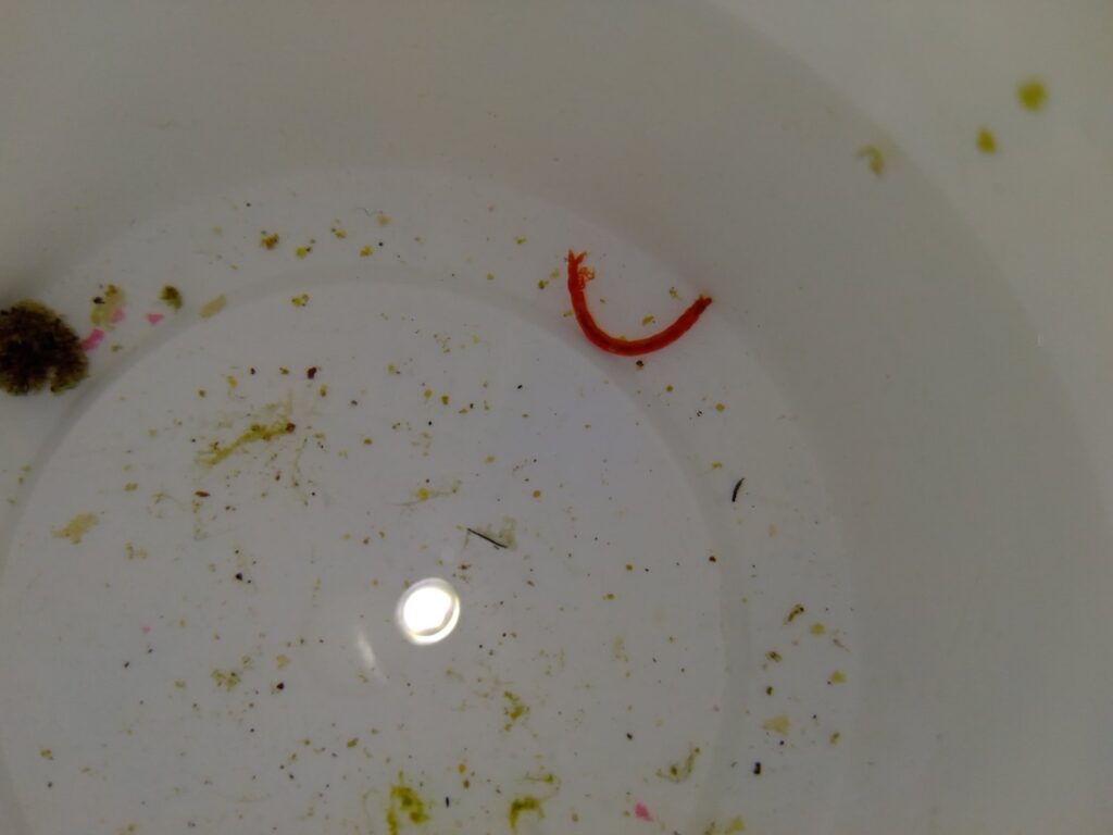 porque salen lombrices rojas en el baño